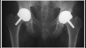 BHR X-Ray